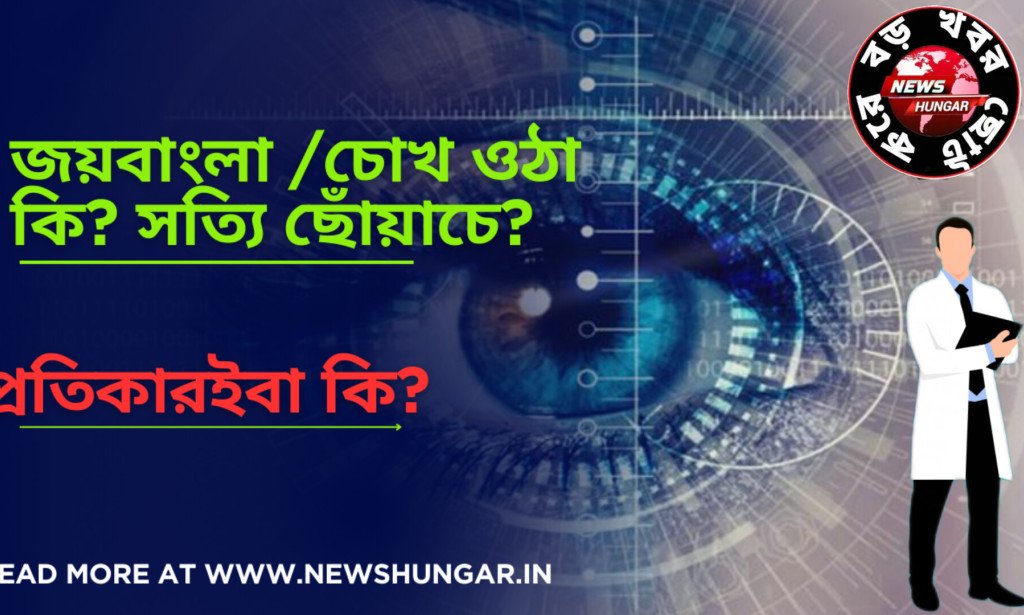 জয়বাংলা /চোখ ওঠা কি সত্যি ছোঁয়াচে?