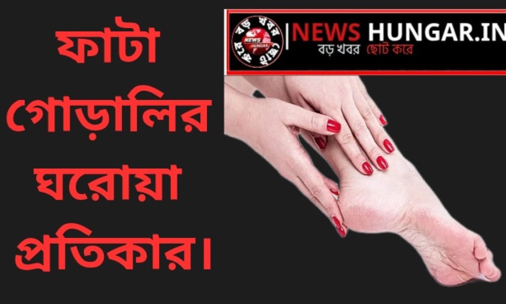 ফাটা গোড়ালির ঘরোয়া প্রতিকার।